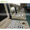 High Quality Laptop Ultrasound Scanner Ultrasound diagnostic devices- BPU16