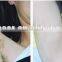 755+1064 Alexandrite laser permanent hair removal machine pigmentation correctors