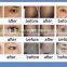 2014 Co2 Skin Care Carboxytherapy Cdt Beauty Machine For Wrinkle Remover/ Glutathione Skin Whitening Injection