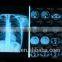 blue film medical x-ray film knd film Kodak film new product film used hospital