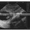 vet ultrasound scanning B-type ultrasound/ pregnancy scanner M50
