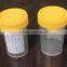 hospital urine container urine bottle sterile