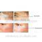 pinxel 2 farctional rf microneedle rf beauty machine face lift wrinkle removal skin lifting