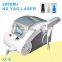 Q switched nd yag carbon peel laser tattoo removal machine