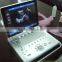 3D 4D Portable Color Doppler Ultrasound System