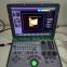 4D Color laptop Doppler Ultrasound