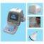 B-Ultrasound Machine---CE Certified