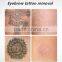 Pico Laser Machine NEW Laser 2016 All Color Tattoo Removal 2017