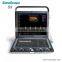 SonoScape S9 color doppler 4d ultrasound machine