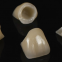 Custom Zirconia Abutment Porcelain Fused to Metal Bridge Made in China Dental Lab