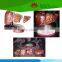 Hot selling Medical teaching human 4-stage liver model