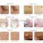 FDA Approved Fractional Co2 Laser For Wrinkles Stretch Mark Removal Removal And Stretch Marks Improve Equipment