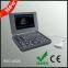 Laptop Ultrasonic Diagnostic System