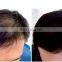 CE certification hair hat/cap/helmet regeneration cap therapy for oil secretion and hair loss