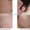 Acne Scar Removal New Vertical Fractional Co2 Vagina Vagina Cleaning Tightening Fractional Laser Machine Skin Care Remove Neoplasms