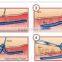 Hot in USA vein silk dispel , spider silk dispel equipment