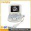 Hospital Used Medical Equipment best resolution digital portable ultrasound machine