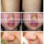 Vascular Removal Spider Vein removal 980nm medical diode laser wholesale distributors wanted