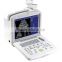 Dog,cat,rabbit and other Pets pregnancy ultrasound scanner with Full-digital (Futai-180)