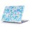 Protective Case For MacBook pro retina 15" 15.4" inch, Protective Case with blue little flower