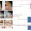 2016 New eye beauty machine eye bag removal machine