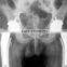 Digital x-ray film