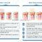 Supper price! approval technology fda approved ipl quantum