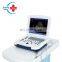 HC-A003 cheap portable ultrasound scanner price with 12 inch HD LCD display