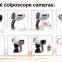 hot sale digital video colposcope with sony camera