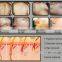 germany bars 808nm diode laser permanent hair removal beauty equipment / 808 nm laser diode portable machine