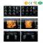 MY-A031A Medical equipment Hospital 4D All Digital Color Doppler Ultrasound Machine