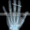 China KND-A/F CE medical dry film disposable medical product
