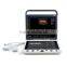 MC-DU-S9 Excellent Superb Portable Color Doppler 3D 4D Ultrasound Machine