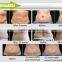 (3/4 cryo handles) cellulite suction massager vacuum cryolipolysis slimming equipment