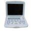 Portable Convex Ultrasound Scanner---CE certified