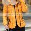 Hot Sell New Design Women Stylish Shiny Down Jacket With Fur Hood