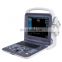 Portable Color Doppler Medical Ultrasound Scanner