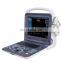 CE Approved Portable Ultrasound Scanner Color Doppler Medical Ultrasound Instruments for hospital