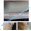 2016 Virtue Beauty Hot Sale q switched alexandrite laser