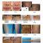 Permanent Factory Price 810nm Diode Laser For Hair Removal 810 Diode Laser Arm / Chest Hair Removal