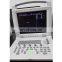 Digital portable ultrasound scanner for sell