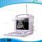 LT3018I portable diagnostic ultrasound machine USG price