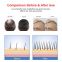 ZJZK Laser Cap - FDA Cleared Hair Laser Growth Treatment For Men & Women - Thinning Hair, Spot Or Full Scalp, Denser/Fuller Hair, Medical Grade Laser