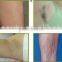 Germany Bars 808nm Diode laser hair removal/skin rejuvenation laser/ 808nm diode laser