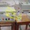 plastic cup corona treatment machine for print /portable Film Corona treatment for print