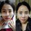 7MHZ Professional HIFU Facial Back Tightening Lifting Salon Ultrasound Machine Price High Frequency Acne Machine