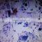 oral pathology prepared slides/teaching oral pathology slides/medical oral pathology slides