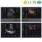 Cheap medical portable color doppler ultrasound elastography ultrasound gel prices