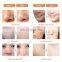 2021 Aqua Peel Korea Ultrasound Facial Cold Hammer Scrubber Aqua Peel RF Wrinkle Removal Beauty Machine