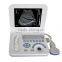 Hospital Full-digital Cheap Battery Diagnosis Equipment Laptop Ultrasound 3018